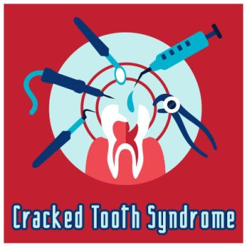 Brooklyn dentists at Park Slope Dental Arts, discuss causes, symptoms, and treatment of cracked tooth syndrome.