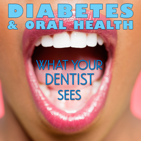 Brooklyn dentists at Park Slope Dental Arts, discusses the side effects of diabetes and how it affects your oral health.