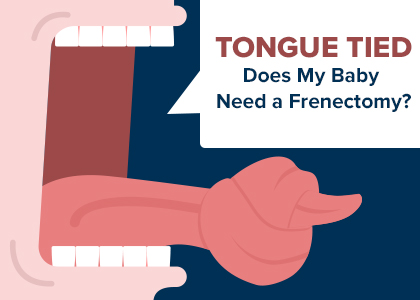Brooklyn dentists at Park Slope Dental Arts, discusses different types of frenums, how they can cause problems for your baby’s mouth, and treatment with frenectomy.