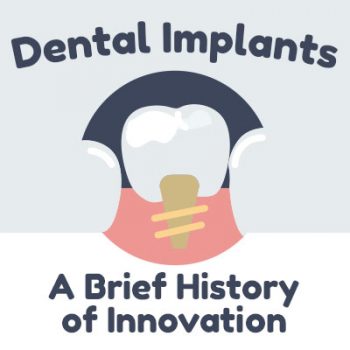 Brooklyn dentists at Park Slope Dental Arts discusses dental implants and shares some information about their history.