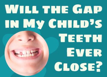 Brooklyn dentists at Park Slope Dental Arts talk about potential causes and treatments for gapped teeth in children.