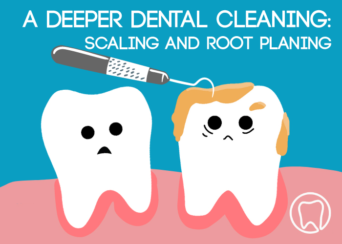 Scaling & Root Planing in Brooklyn, NY Park Slope Dental Arts