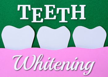 Brooklyn dentists at Park Slope Dental Arts shares everything you need to know about different types of teeth whitening.