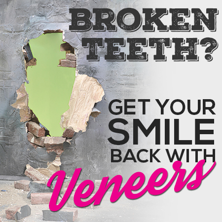 Broken teeth?  Get your smile back with veneers.