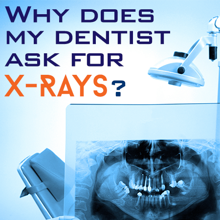 Brooklyn dentists at Park Slope Dental Arts, discusses the importance of dental x-rays for accurate diagnosis and treatment planning.
