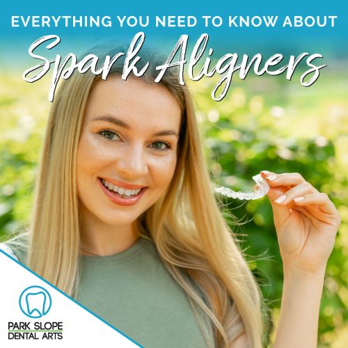 Spark Aligners<sup>®</sup> in Brooklyn: The Modern Clear Aligner Choice for a Straighter Smile (featured image)