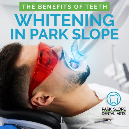 The Benefits of Teeth Whitening in Park Slope (featured image)